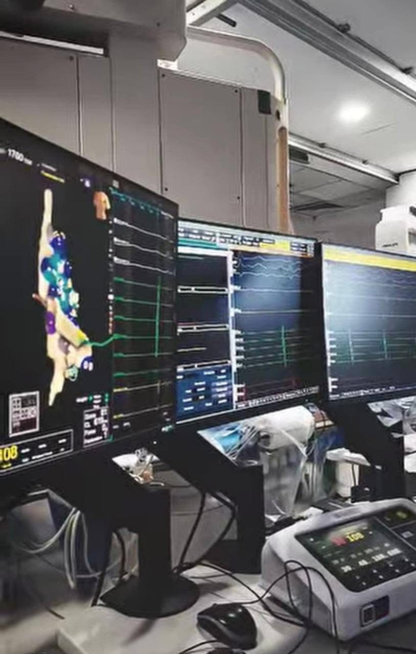 نجاح تقنية «كيّ العقد العصبية» بمستشفى النصر التخصصي