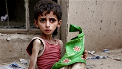 أزمة سوء التغذية في غزة: أطفال في خطر والمواد الغذائية شحيحة