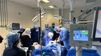 نجاح أولى عمليات زراعة القوقعة في أسوان والسويس تحت مظلة التأمين الصحي الشامل